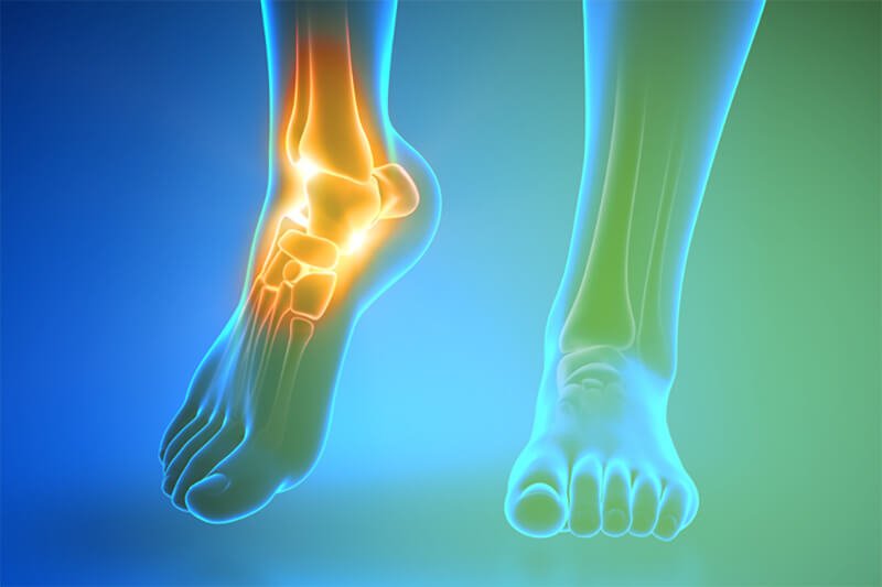 Fisiospecialist – Fisioadvance